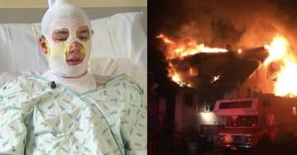 Hero uncle says he would do it again after suffering third degree burn, saving his niece.