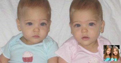 Most beautiful twins in the world that went viral after posting their first photo on Instagram on 7 July 2017.