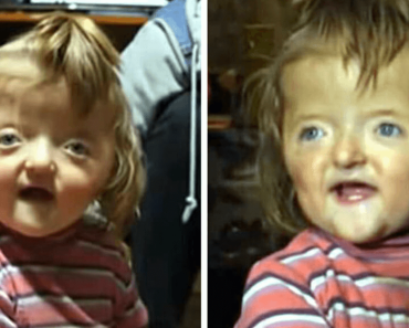 A 2-Year-Old Girl Declined by a School Just Because of how She Looks