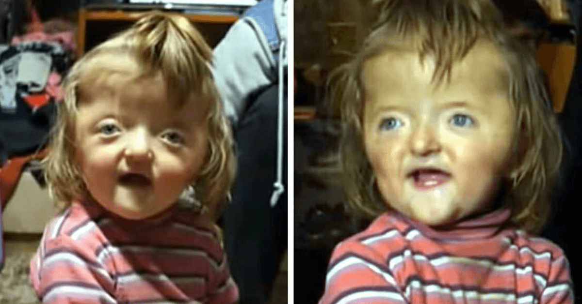 A 2-Year-Old Girl Declined by a School Just Because of how She Looks