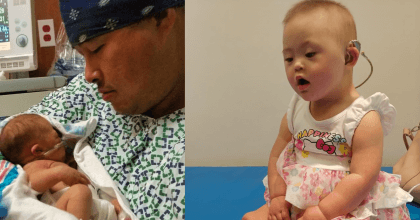 Baby born with leukemia and down syndrome hears sound for the first time.