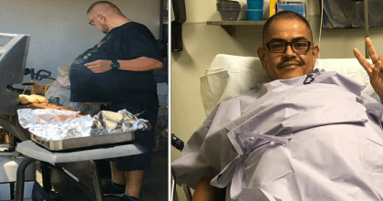 Man was bullied from his ‘beer belly’.  Turns out it was a 77-pound tumor