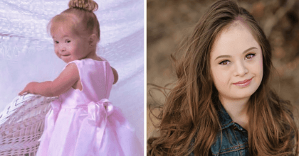 Girl almost got institutionalised by doctors because of her down syndrome – Proves them wrong by becoming a model