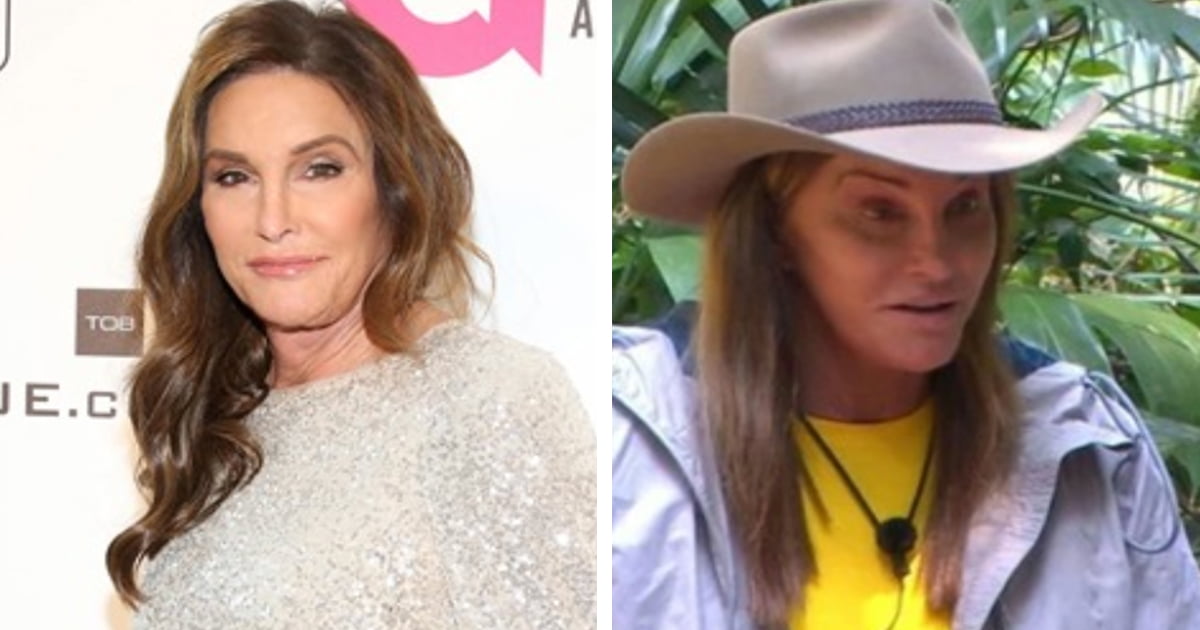 Caitlyn Jenner appears without make-up and everyone gets an answer