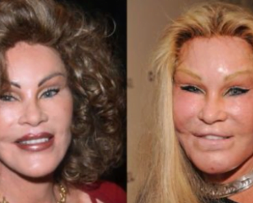 21 Botched Surgeries That Went Horribly Wrong.