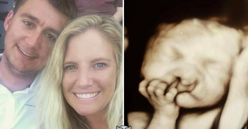 Parents refuse to terminate the pregnancy with the “malformed” baby – this is what the 2-year-old looks like now