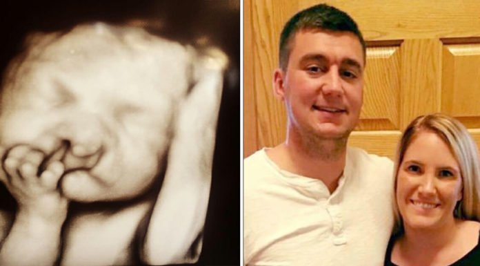 Parents told to abort baby because of a deformity refuse to accept doctors’ advice – take a look at how their precious son looks like today