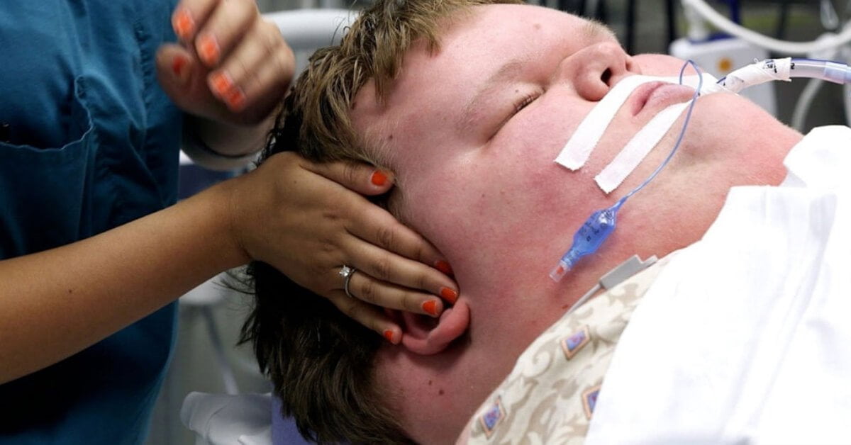 Heaviest Teenager In The World At 715lbs Gets Life-Changing Weight Loss Surgery