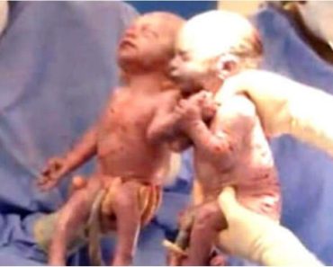 Doctor Gasps Seconds After Delivering Twins, Looking Down We See Why!