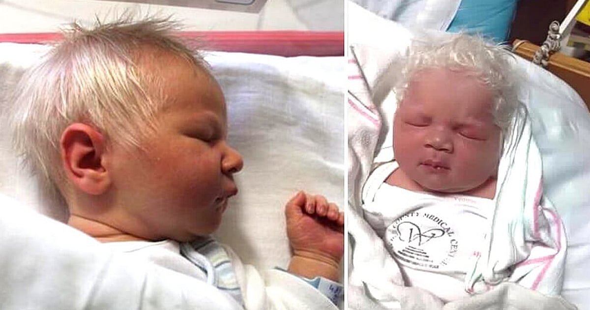 Baby boy born with snow-white hair dubbed “Prince Charming”