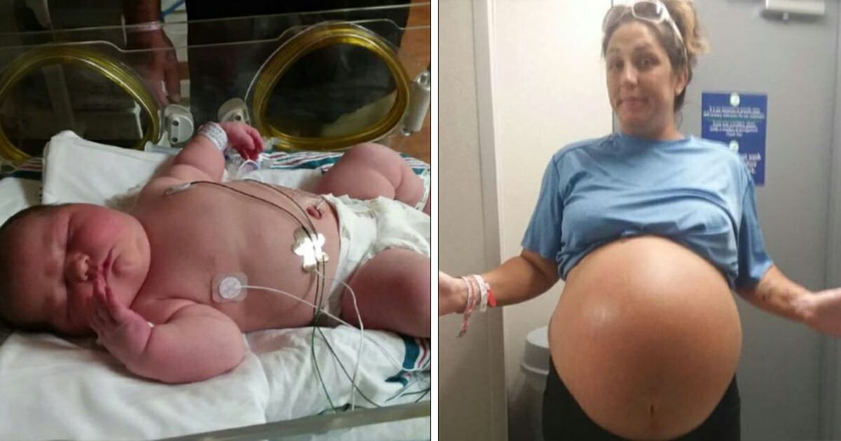 Doctors amazed after mom gives birth to a 13lb baby