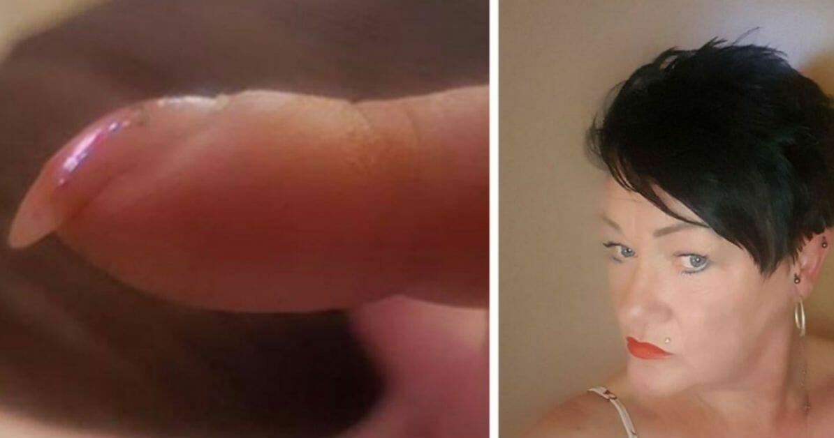 Mom posts pics of her nails on Facebook – gets message that could save her life