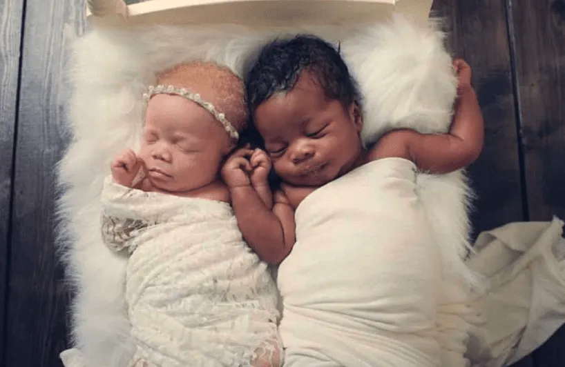 People Don’t Believe Mom When She Gives Birth To Twins, One Black And One White