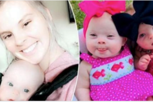 Celebrating the Beauty of Rare Twins with Down Syndrome