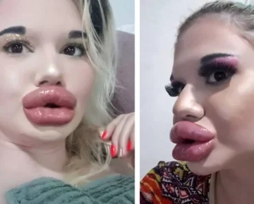 She lost all her beauty because of surgeons and here is what she used to look like before…