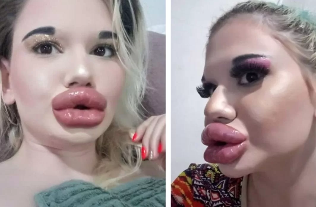 She lost all her beauty because of surgeons and here is what she used to look like before…