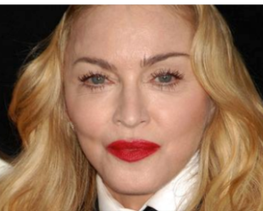 Madonna Looks ‘Unrecognizable’ Now—A Plastic Surgeon Weighs In