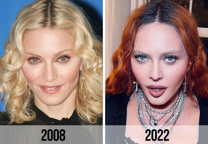 Madonna before and after 2008 vs 2022