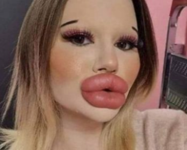 Pursuing the Dream of the Biggest Lips: Andrea Ivanova’s Extraordinary Journey