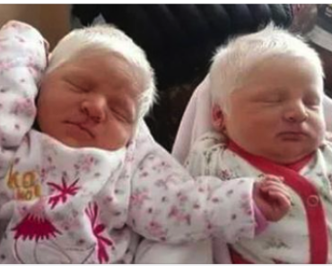 The First Ever Albino Twins Born In Argentina Will Leave You In Awe