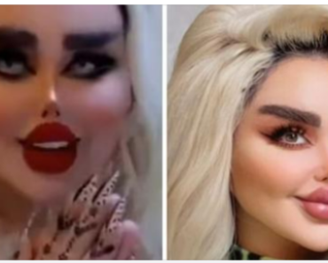 She Had 43 Cosmetic Procedures To Become A Barbie Doll – But Critics Say She Look Like A ‘Zombie’