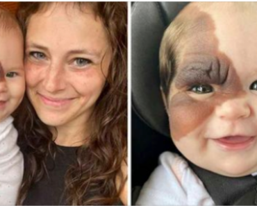 Mother wants to show 13-month-old daughter with rare birthmark how she is beautiful