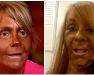 Mom-of-5 obsessed with tanning was accused of “burning” her 6-year-old in a tanning booth