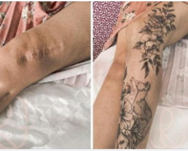 Tattoos that help turn your scars into something beautiful