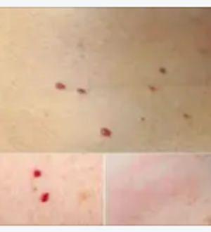 Red Dots on Skin