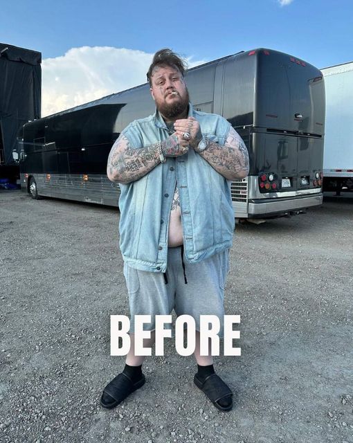 Country Singer Jelly Roll Shed 100 Pounds: Wait Till You See How He Looks Now