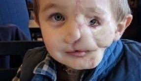 Boy, nearly 7, who lost half his face after being attacked by dogs is called ‘monster’ in public