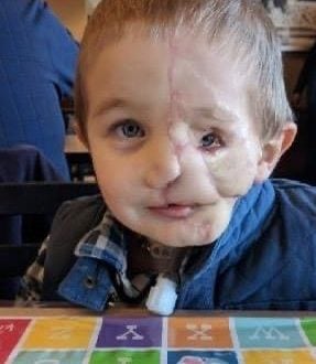 Boy, nearly 7, who lost half his face after being attacked by dogs is called ‘monster’ in public