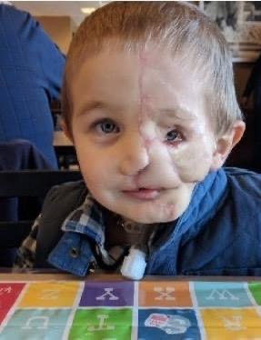 Boy, nearly 7, who lost half his face after being attacked by dogs is called ‘monster’ in public