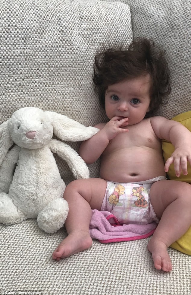 Remarkable Baby Born with Abundant Hair in Sydney