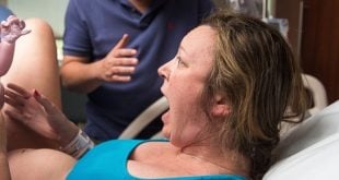 Remarkable Baby Born with Abundant Hair in Sydney