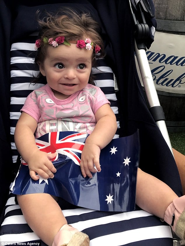 Remarkable Baby Born with Abundant Hair in Sydney