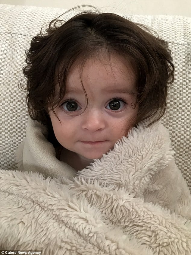 Remarkable Baby Born with Abundant Hair in Sydney