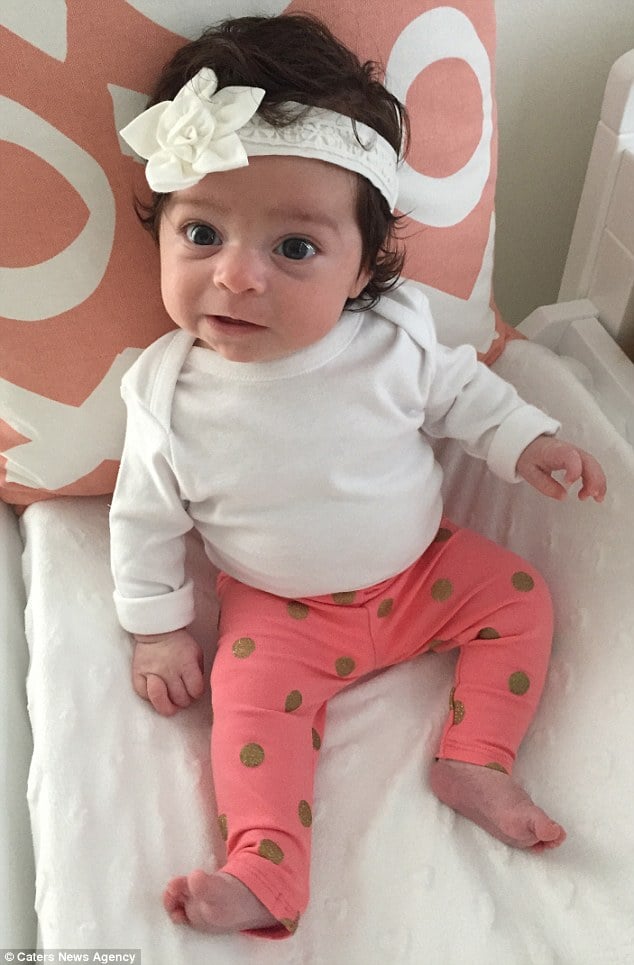 Remarkable Baby Born with Abundant Hair in Sydney