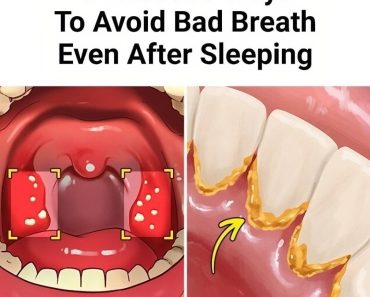 6 Proven Ways to Avoid Bad Breath