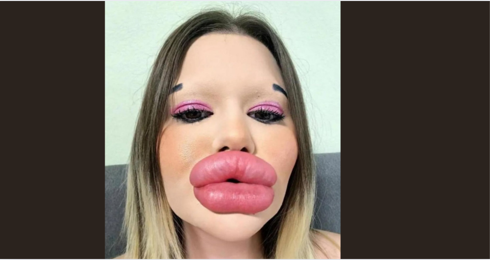 The individual boasting the largest lips on the planet!