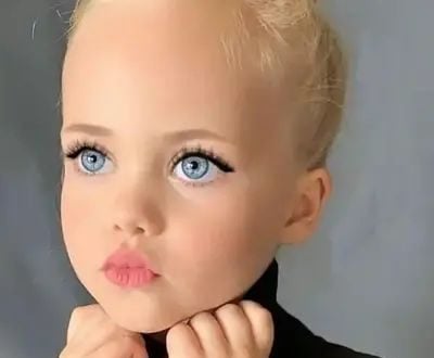 At the age of 4, she was dubbed ‘the most beautiful girl in the world’ – This is what she looks at 20 years old