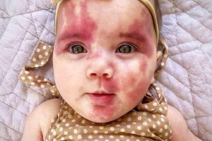 Baby called ‘hideous’ is a gorgeous little girl now