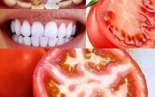 Brighten your smile naturally: Tomato teeth whitening