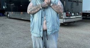 Country Singer Jelly Roll Shed 100 Pounds – Wait Till You See How He Looks Now…