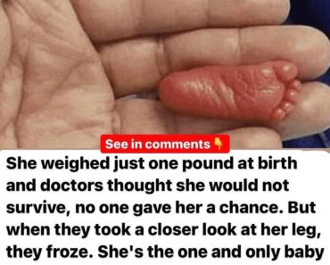 She weighed less than a pound at birth and doctors thought she would not survive