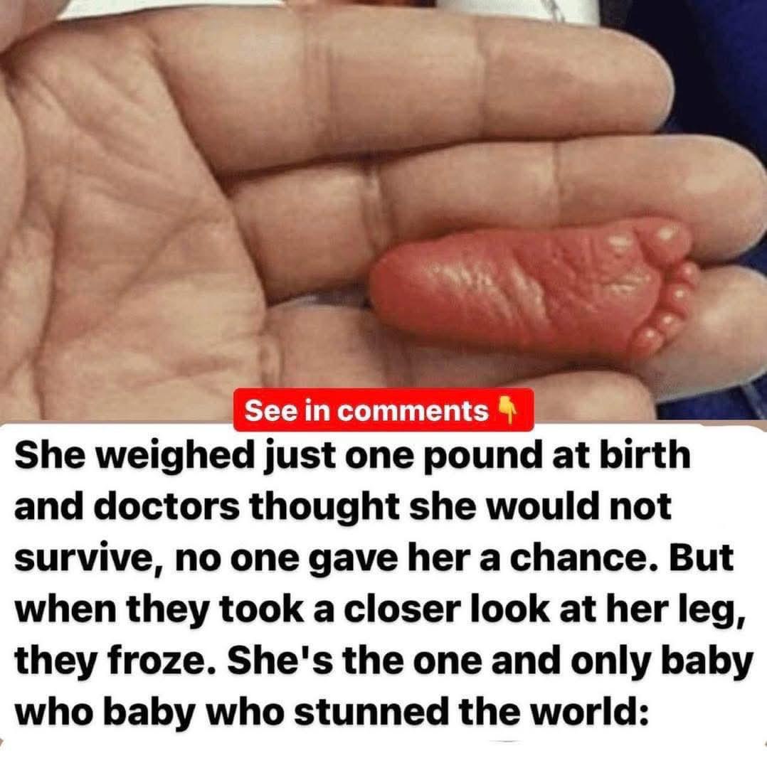 She weighed less than a pound at birth and doctors thought she would not survive