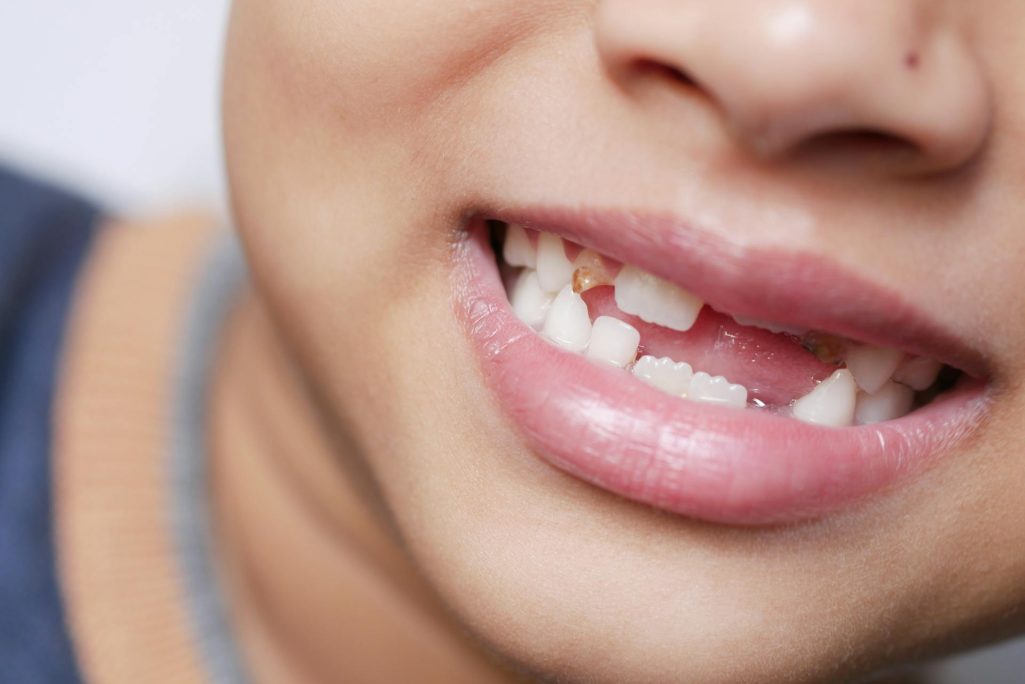 A close-up shot of a boy's mouth as he speaks | Source: Pexels