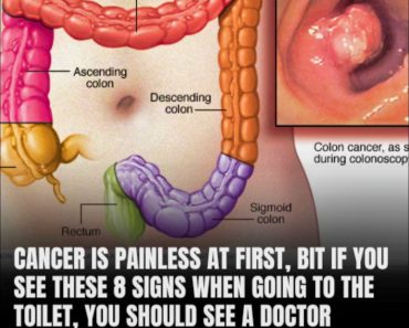 How Your Bowel Movements Reveal Clues About Colon Cancer