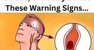 A Month Before a Stroke: Know the Warning Signs