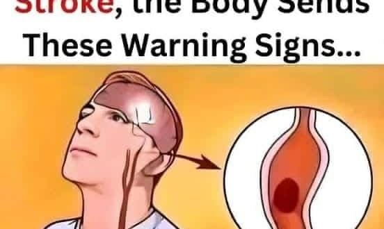 A Month Before a Stroke: Know the Warning Signs